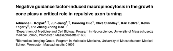 Negative guidance factor-induced macropinocytosis in the growth cone plays a critical role in repulsive axon turning